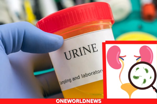 Urine Infection Prevention