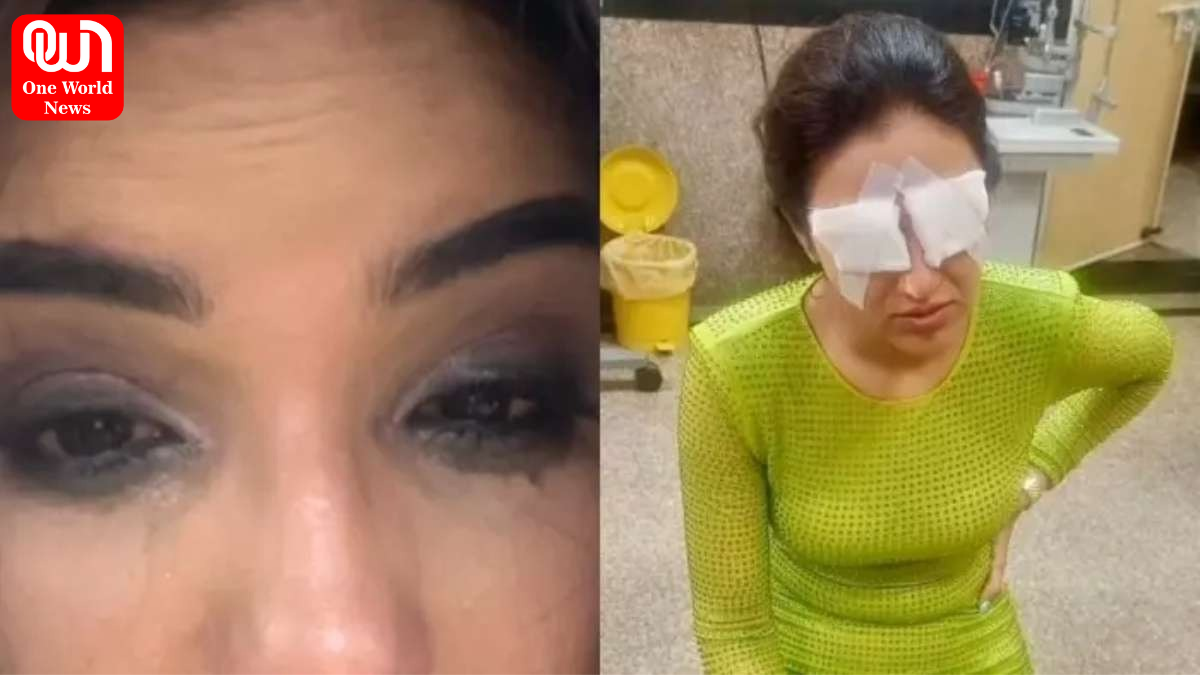 Jasmine Bhasin's Eyes Got Damaged