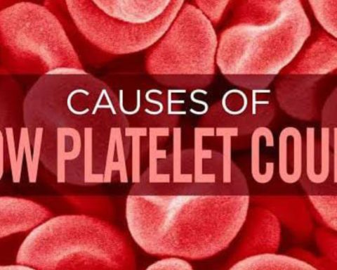 Platelet Count