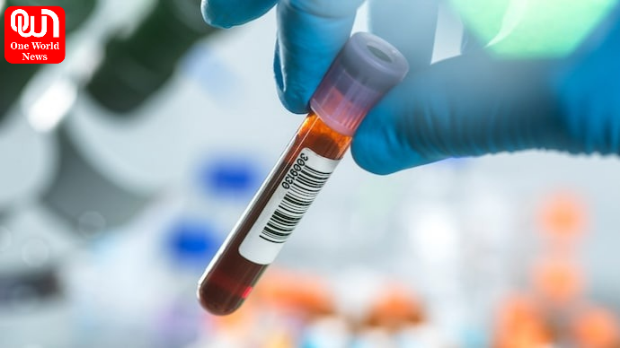 US FDA Approves New Blood Test