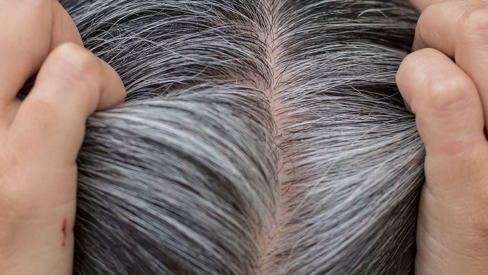 Gray Hair Solution 