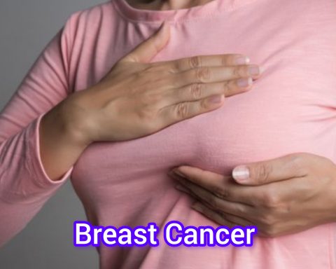 Breast Cancer