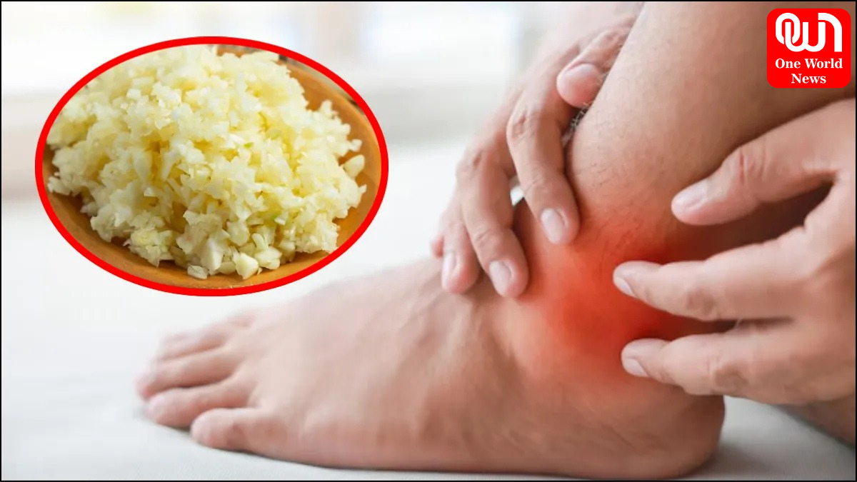 Home Remedies For Uric Acid