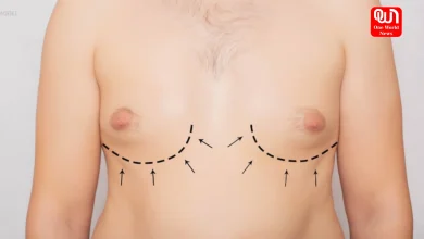 Male Breast Causes