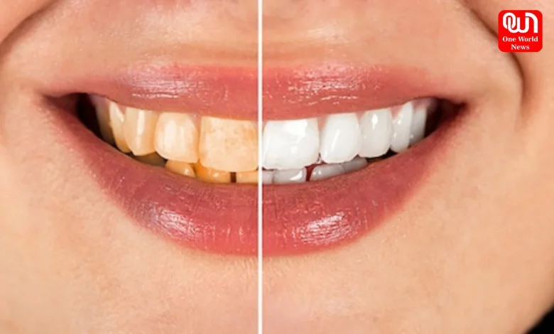Teeth Whitening Tips