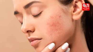 Acne And Gut Health