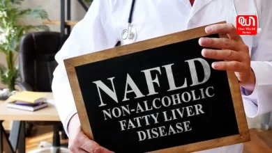 Non-Alcoholic Fatty Liver Disease