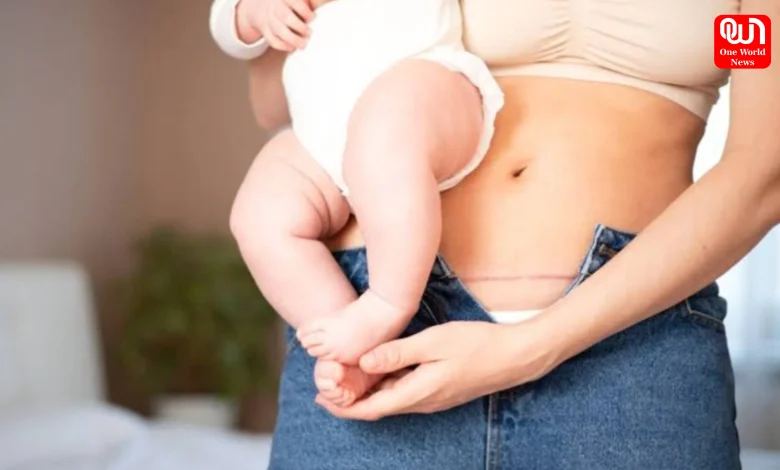 Recovering After a C-Section