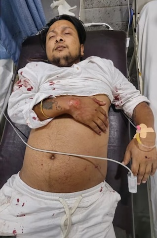 Pawandeep Rajan Health Update
