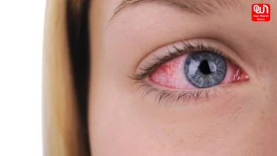 Red Eye Season