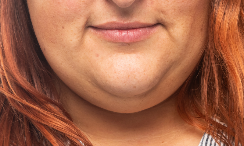Facial exercises for double chin