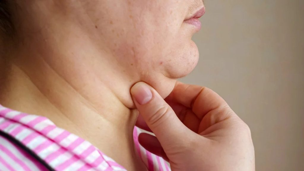 Facial exercises for double chin