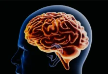 Brain Declutter Techniques