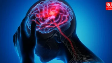 Brain Hemorrhage Survival Time