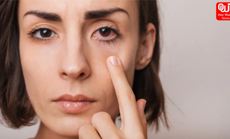 Eye Care Tips During Monsoon
