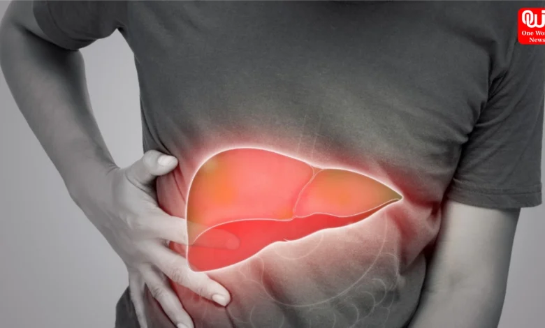 Home Remedies for Fatty Liver