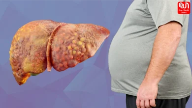 Snacks for Fatty Liver