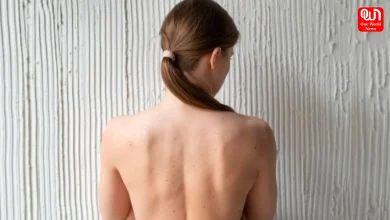 Back Acne
