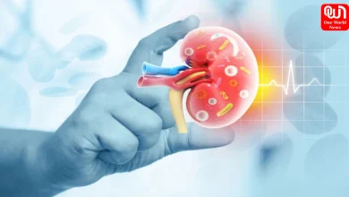 CKD Causes in Young Adults