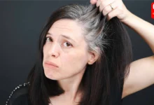 Causes Of Gray Hair