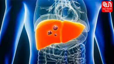 Fatty Liver And Cancer
