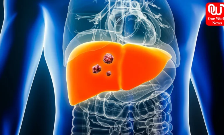 Fatty Liver And Cancer