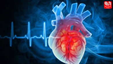 AHA ACC Cholesterol Guidelines