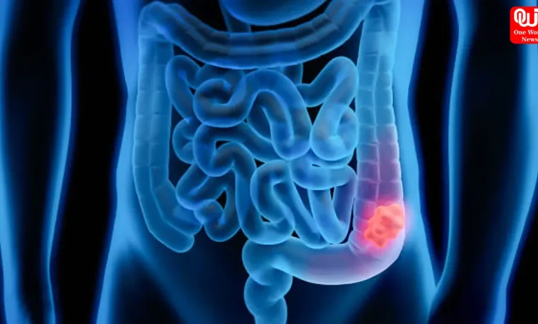 Blood in Stool