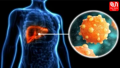 Fatty Liver And Liver Cancer Risk