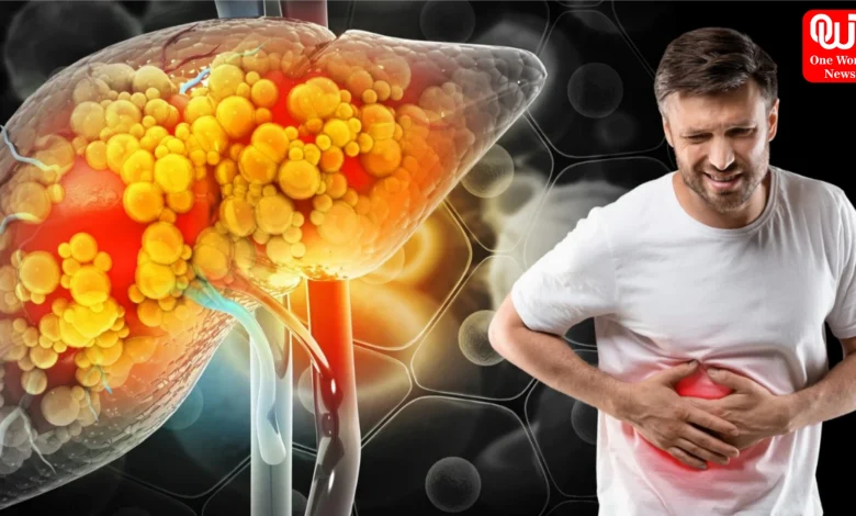 Fatty Liver Disease