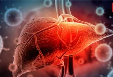 How To Keep Liver Healthy