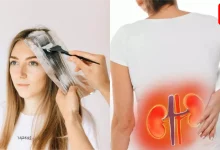 Kidney Health Risks from Hair Dye