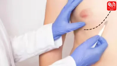 Male Breast Cancer