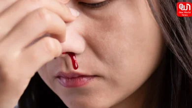 Nose Bleeding Causes