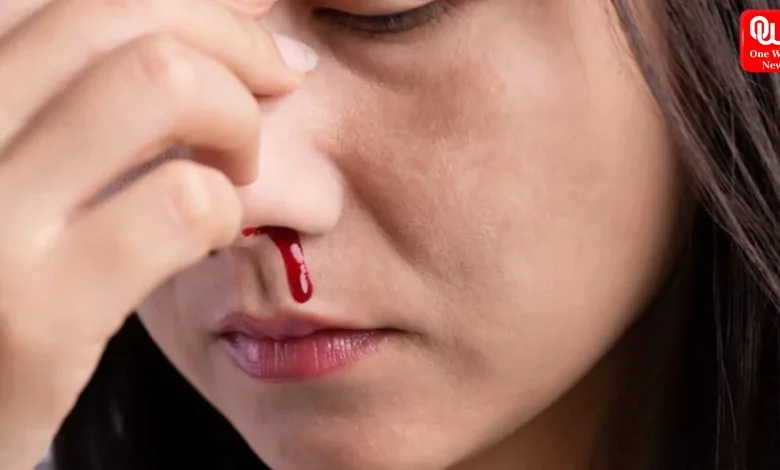 Nose Bleeding Causes