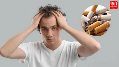 Smoking and Hair Loss
