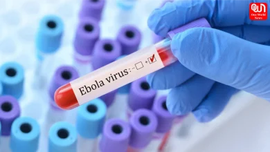 Ebola Virus