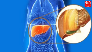 Lean Fatty Liver Disease