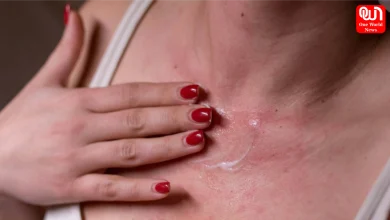 Itchy Skin In Summer