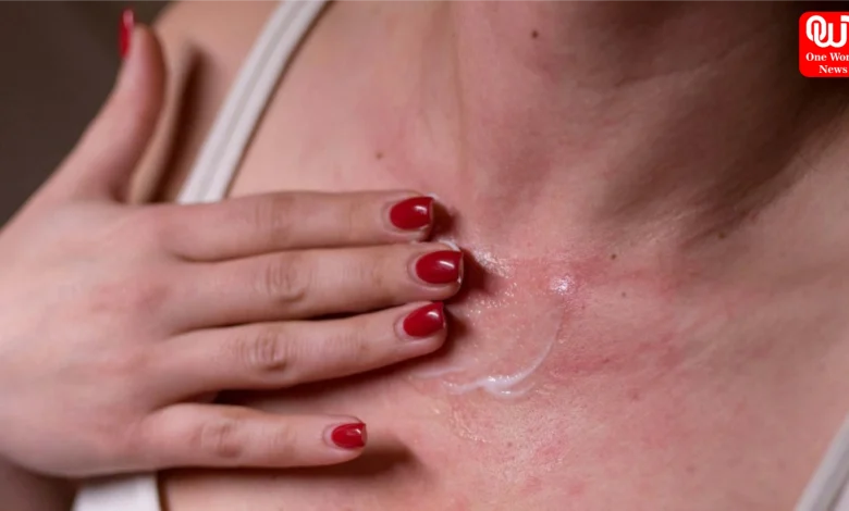 Itchy Skin In Summer