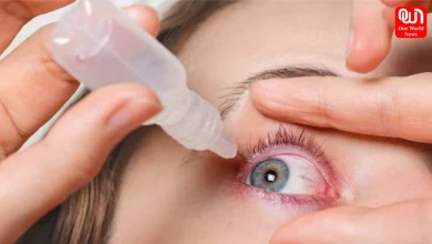 Monsoon Eye Infection