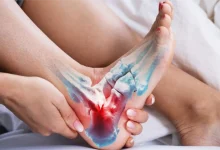 Morning Heel Pain