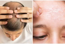 Omega-3 Deficiency