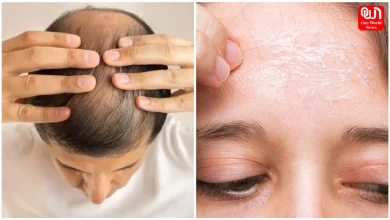 Omega-3 Deficiency