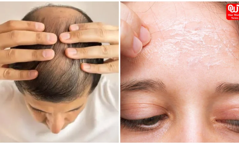 Omega-3 Deficiency