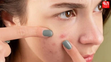 Monsoon Skin Care