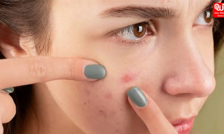Monsoon Skin Care