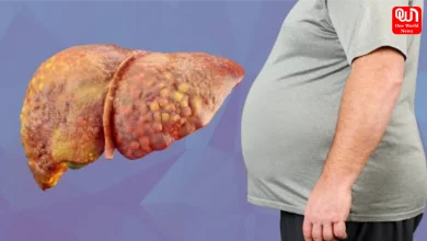 Fatty Liver Disease