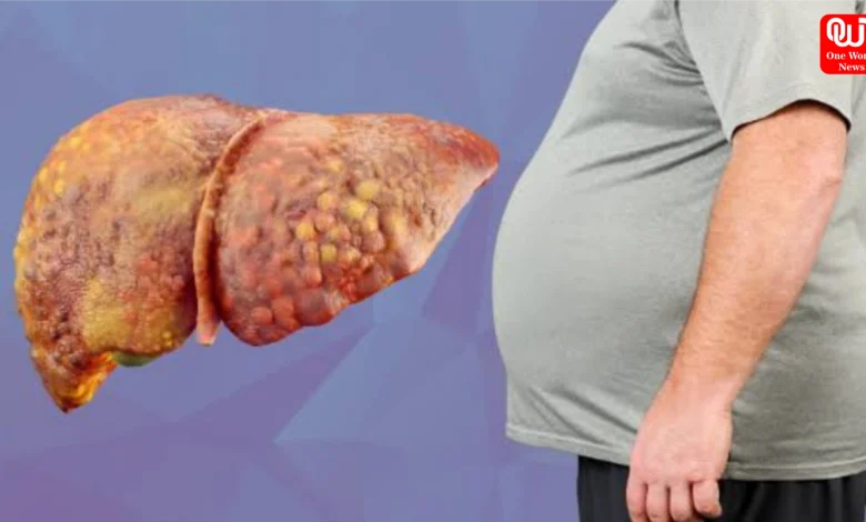 Fatty Liver Disease