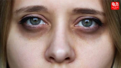 How To Remove Dark Circles